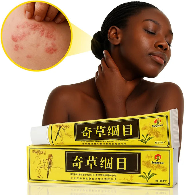 Traitement anti Eczéma, psoriasis et les démangeaisons