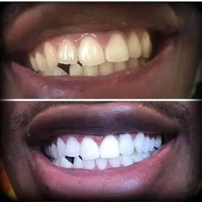 Dentifrice Sp-4 Pour La Gestion de la santé bucco-dentaire - GN